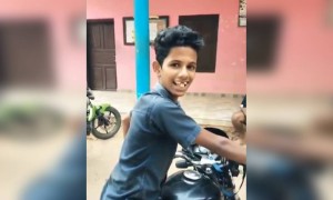 ഇങ്ങനെ ഒരു പല്ല് ഞാൻ കണ്ടിട്ടില്ല